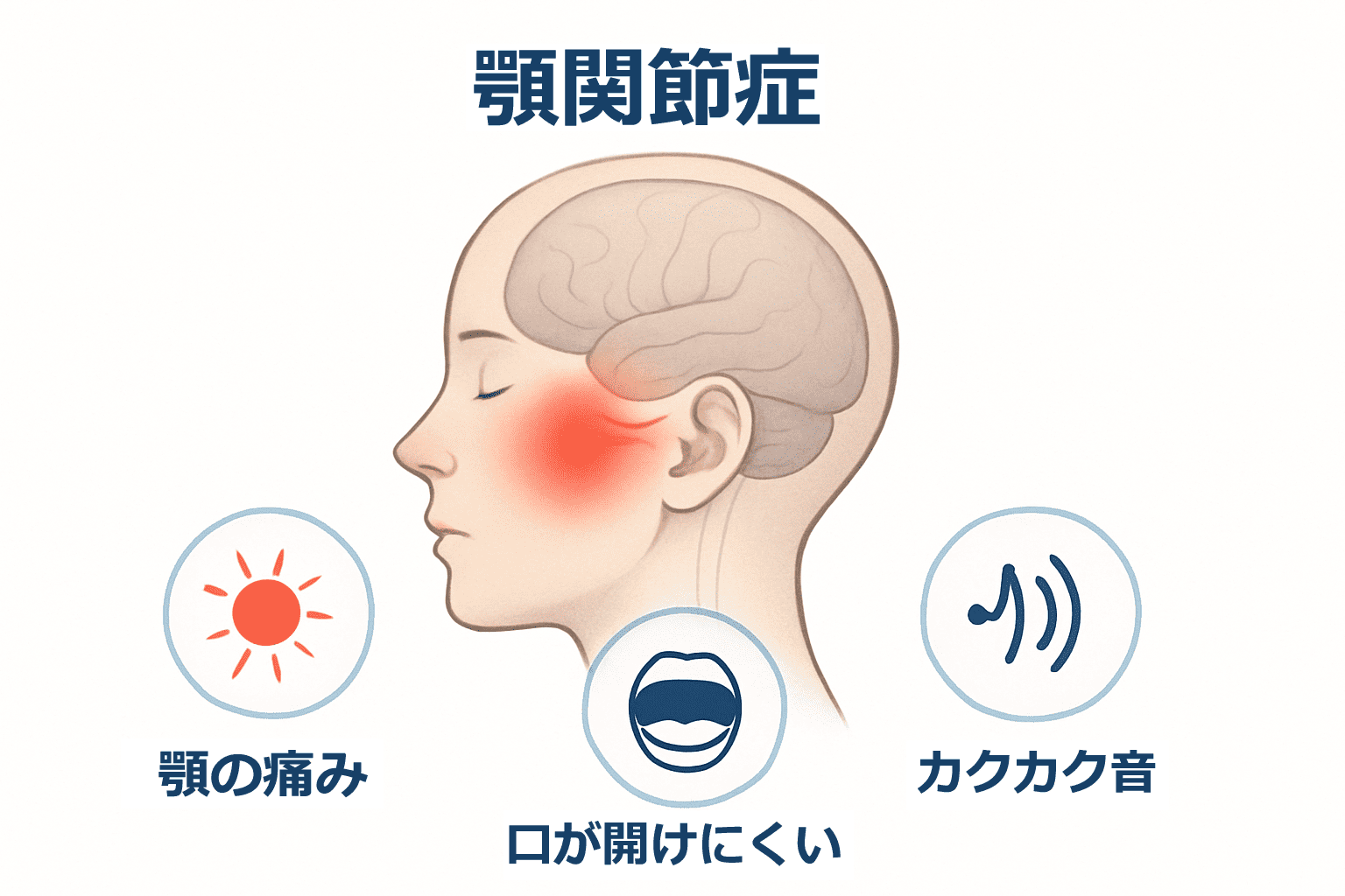 顎関節症の主な症状を示した図解イラスト