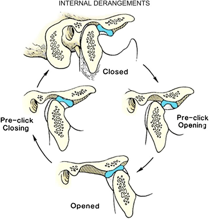 顎関節と関節円板の役割